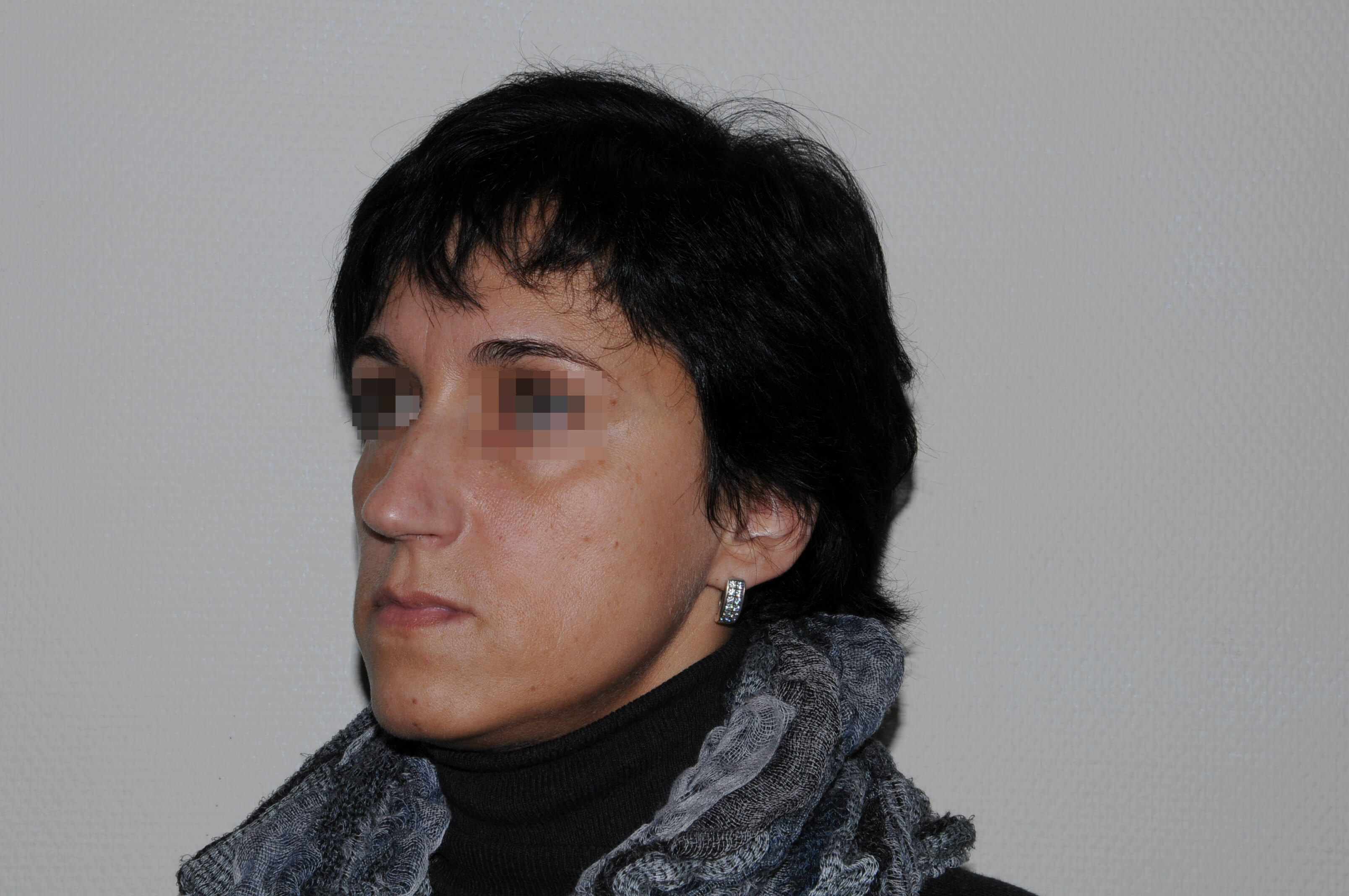 Пациент 5