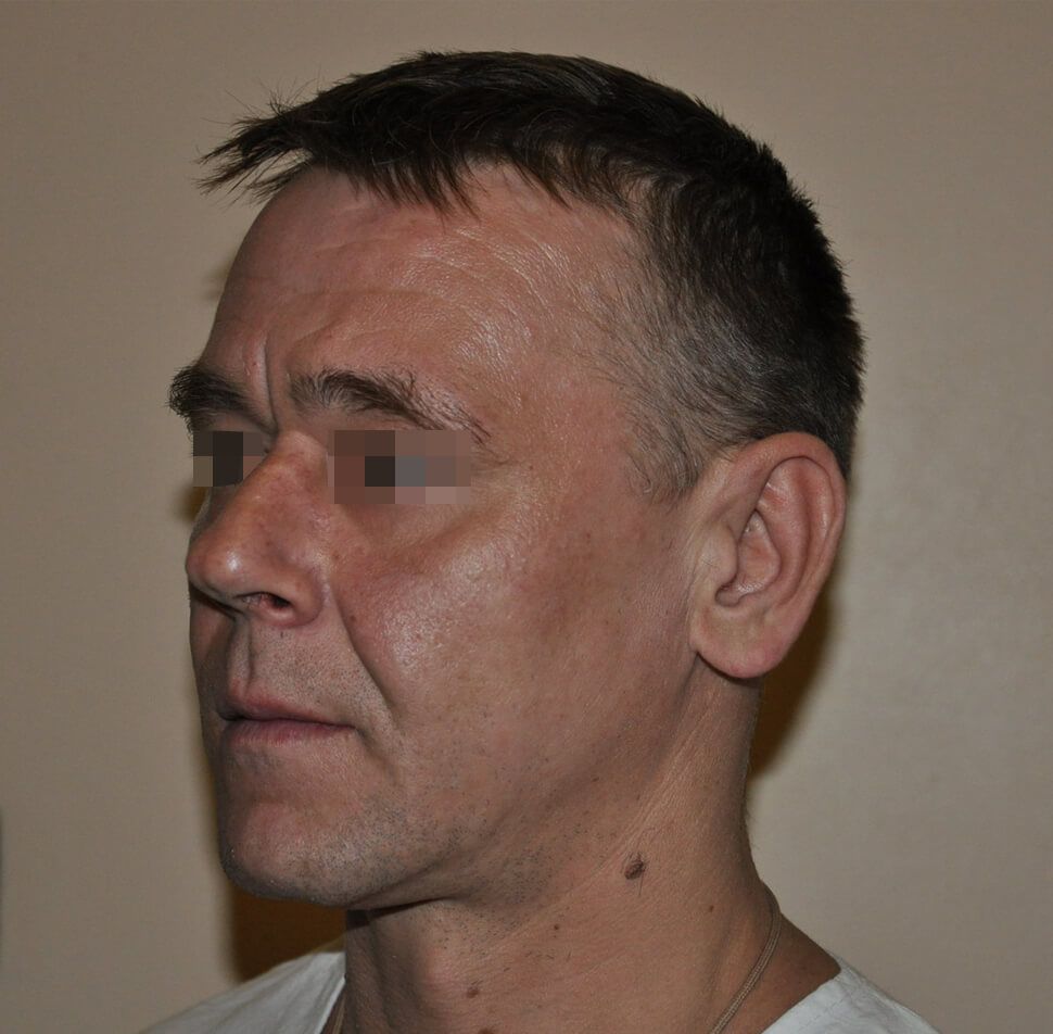 Пациент 3