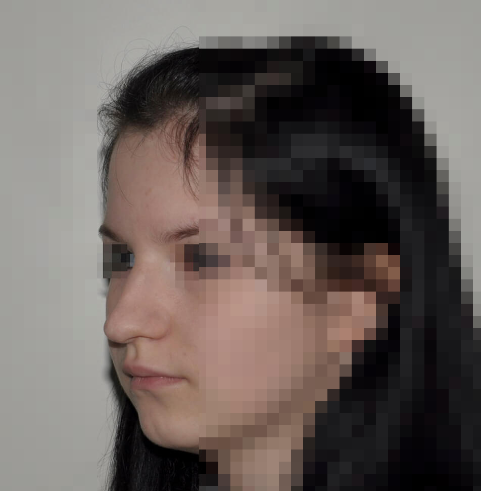 Пациент 2