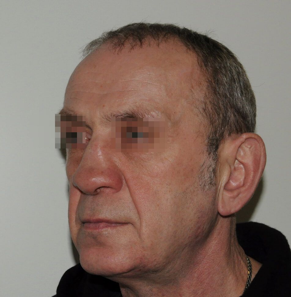 Пациент 4